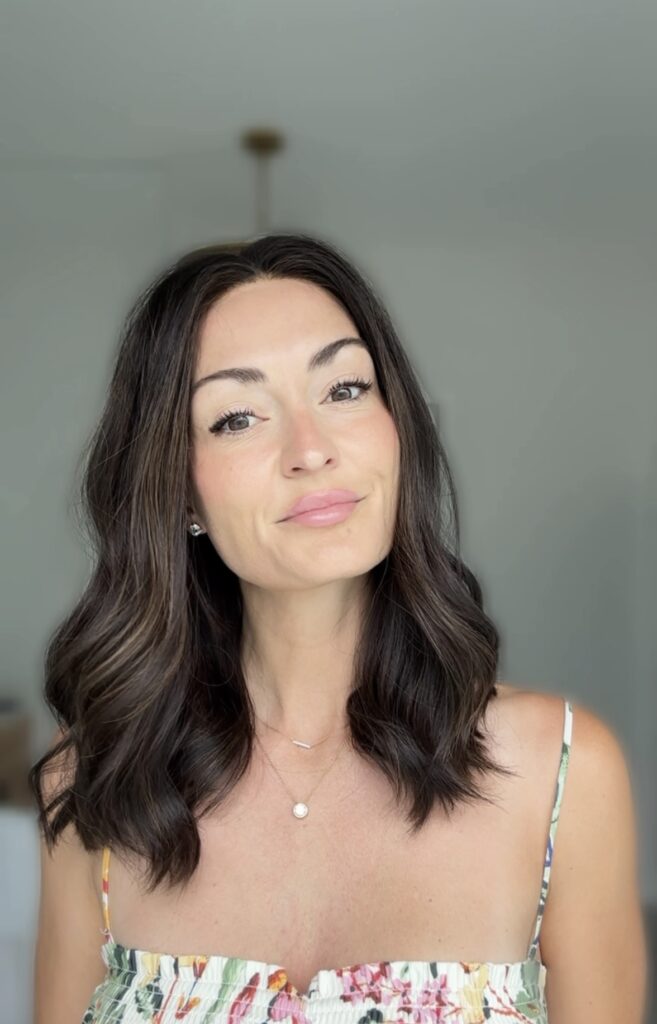 the emotional impact of hair loss